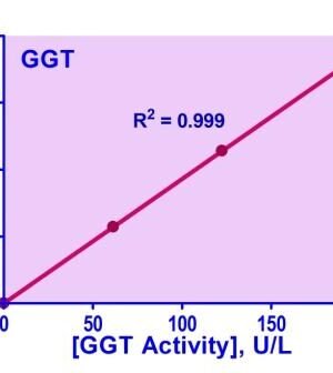 QuantiChrom™ γ-Glutamyl Transferase Assay Kit