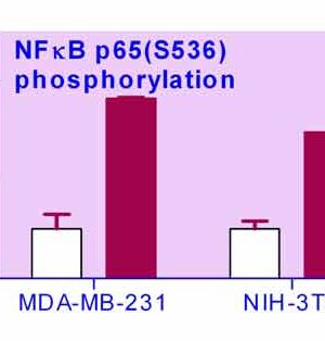 NFKB Phosphorylation Assay Kit