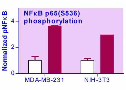 NFKB Phosphorylation Assay Kit